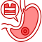 Peptic Ulcer